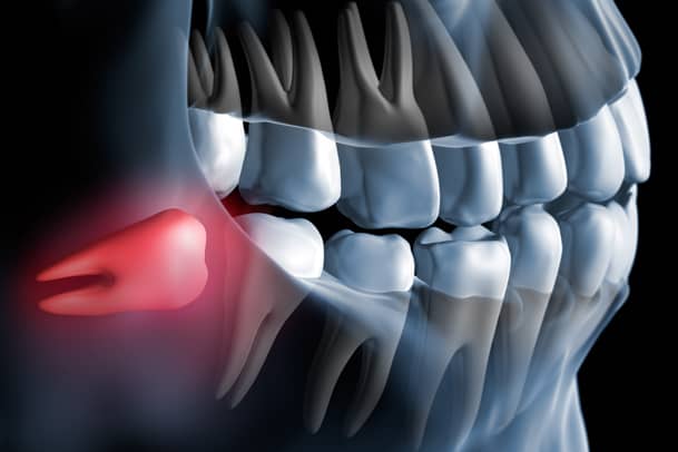 Treatment - Priors Hall Dental