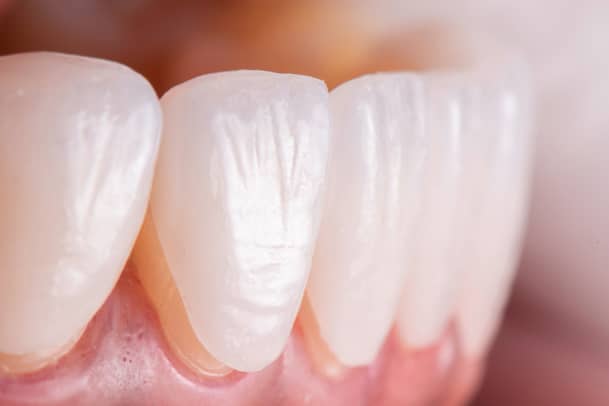 Treatment - Priors Hall Dental